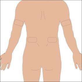 Schiena umana con evidenziate quattro aree rettangolari per possibili siti di iniezione sottocutanea o intramuscolare