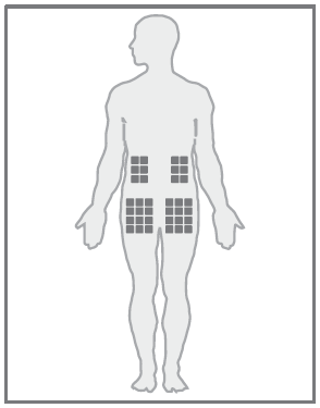 Schema del corpo umano frontale con aree ombreggiate su fianchi e addome indicate per iniezioni sottocutanee
