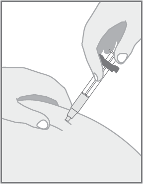Mano che tiene una siringa con ago inserito nella pelle, dettaglio dell