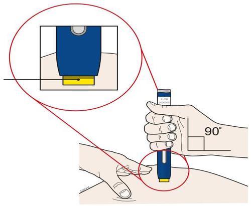 Dispositivo per iniezione con ago posizionato a 90 gradi sulla pelle del braccio e dettaglio ingrandito del meccanismo