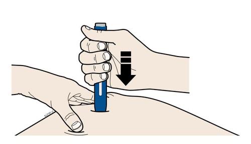 Mano che tiene un dispositivo blu a forma di penna premendo verso il basso sulla pelle del braccio con una freccia nera