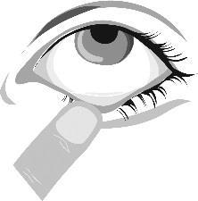 Occhio umano con palpebra inferiore abbassata e applicazione di una goccia oculare trasparente