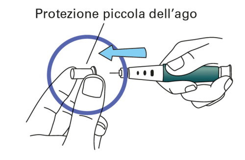 Mano che tiene una penna per iniezione con ago protetto, freccia blu indica la direzione di rimozione del cappuccio protettivo
