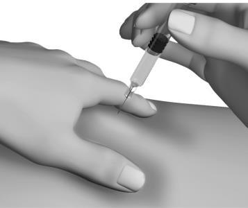 Mano che tiene una siringa con ago inserito nella pelle di un braccio, tecnica di iniezione sottocutanea