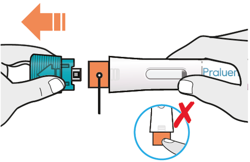 Mani che assemblano un dispositivo medico con due componenti colorati blu e arancione una freccia indica la direzione corretta e una croce indica un errore