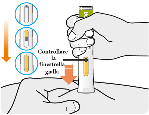 Mano che tiene un dispositivo di iniezione con finestra gialla e freccia che indica il controllo della finestrella
