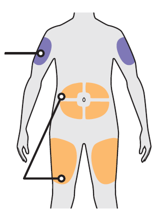 Corpo umano stilizzato con aree colorate in arancione e viola che indicano possibili siti di iniezione sottocutanea o intramuscolare