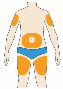 Corpo umano stilizzato con aree arancioni che indicano siti di iniezione sottocutanea su braccia, cosce e addome