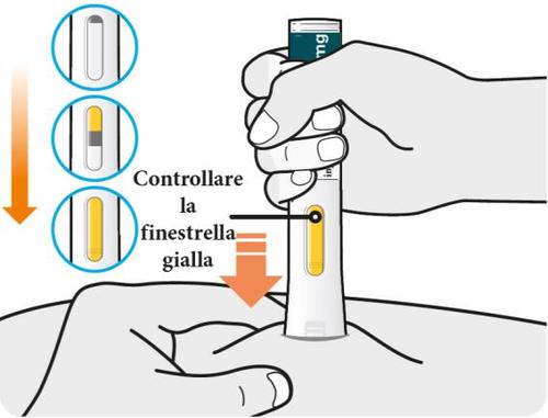 Mano che tiene un dispositivo per iniezione con finestra di controllo e freccia che indica la verifica del livello del liquido giallo