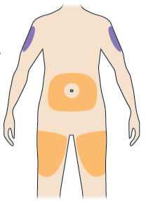 Corpo umano stilizzato con aree evidenziate in arancione su fianchi, cosce e addome per indicare siti di iniezione