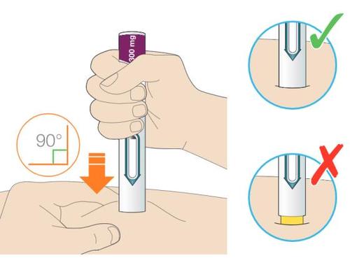 Mano che tiene un dispositivo per iniezione con ago rivolto verso il basso e indicazioni angolari di 90&deg; e iniezione corretta/errata