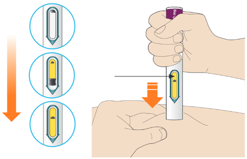 Mano che tiene un dispositivo iniettore con ago, freccia rossa indica la pressione e tre fasi di iniezione mostrate in cerchi blu