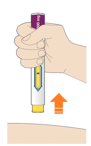 Mano che tiene un iniettore con cartuccia viola 300mg puntato verso la pelle con freccia arancione indicante la direzione