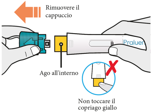 Mano che rimuove il cappuccio giallo da un dispositivo medico Praluer con ago interno indicato da una freccia e avviso di non toccare