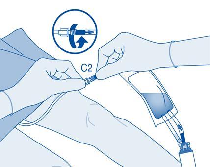 Mani che collegano un dispositivo medico trasparente ad una sacca per infusione blu con indicazione C2 e frecce rotazionali