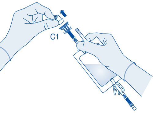 Mani che assemblano un dispositivo medico con connettore e cilindro trasparente contenente liquido blu