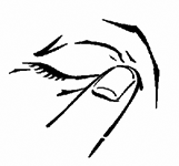 Mano che stringe una siringa con ago inserito nella pelle, tecnica di iniezione sottocutanea con angolo di circa 45 gradi