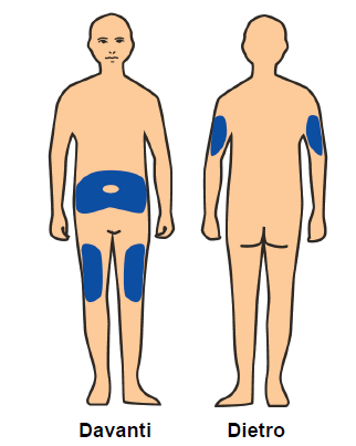 Due figure umane stilizzate mostrano le aree di iniezione evidenziate in blu: fianco, cosce anteriormente e glutei posteriormente