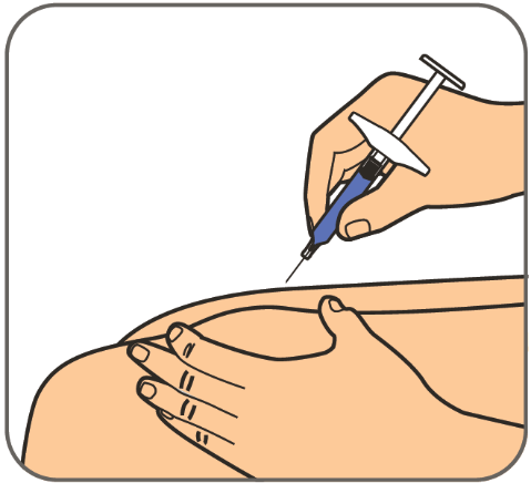 Mano che tiene una siringa con ago inserito nella pelle di una coscia, tecnica di iniezione sottocutanea illustrata con dettagli anatomici semplificati
