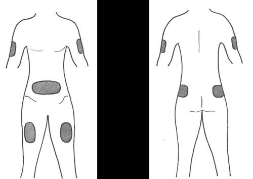 Due schemi del corpo umano con indicazioni di siti di iniezione intramuscolare nella coscia e nel gluteo