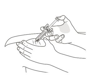 Mano che tiene una siringa preriempita con ago inserito nella pelle del braccio per iniezione sottocutanea