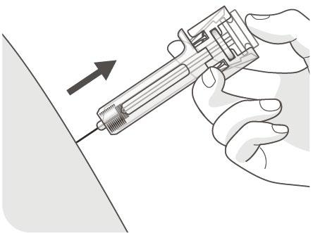 Mano che tiene un autoiniettore con ago inserito nella pelle, freccia nera indica la direzione di iniezione