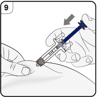 Mano che tiene una siringa blu con ago inserito nella pelle, freccia che indica la direzione di iniezione e numeri in alto a sinistra
