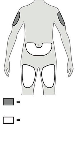 Schema del corpo umano con aree evidenziate su spalle, fianchi e ginocchia e legenda che indica aree di iniezione