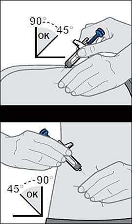 Mano che tiene una siringa blu e grigia inclinata a 45 gradi per iniezione sottocutanea su pelle chiara con angoli indicati