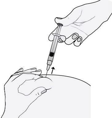 Mano che tiene una siringa inclinata che inietta un farmaco nel braccio di un paziente con ago inserito nella pelle