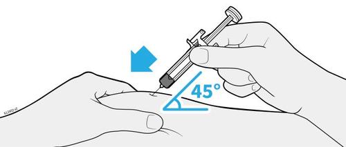 Mano che tiene una siringa con ago inserito nella pelle a 45 gradi indicati da un angolo e freccia blu