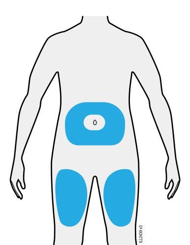 Schema del corpo umano con evidenziate in blu le aree di iniezione addominale e glutei