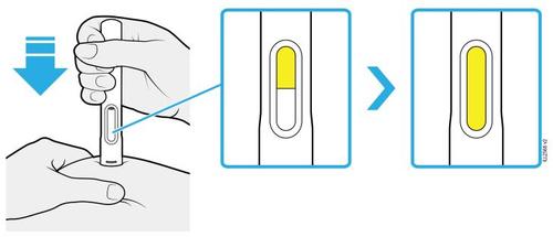 Mano che inserisce una penna precompilata con ago trasparente in un dispositivo di sicurezza con freccia blu indicante la direzione