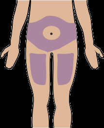Addome e parte superiore delle cosce evidenziate in viola con una linea verticale nera che indica il punto di iniezione