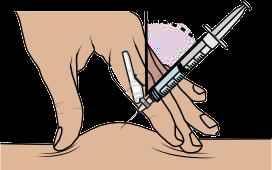 Mano che tiene una siringa pronta per l