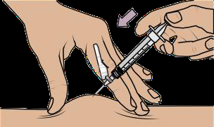 Mano che afferra una siringa con ago inserito nella pelle, con una freccia viola che indica la direzione dell