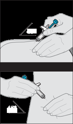 Mano che tiene una siringa con ago inserito nella pelle a 45 gradi, evidenziando l