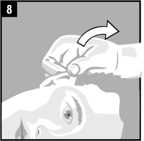 Mano con guanto che stringe un dispositivo sottocutaneo con freccia curva indicante la direzione di inserimento
