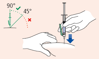 Mano che tiene una siringa inclinata a 45 gradi per iniezione sottocutanea con freccia blu che indica la pressione e angolazione corretta