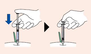Mano che tiene una siringa con ago inserito nella pelle, freccia blu indica la direzione di spinta e freccia nera la posizione finale