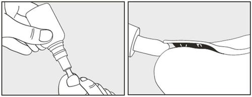 Mano che collega un adattatore alla siringa preriempita e dettaglio dell