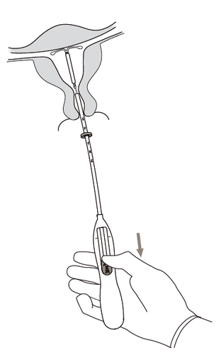 Mano che impugna un dispositivo medico inserito nell