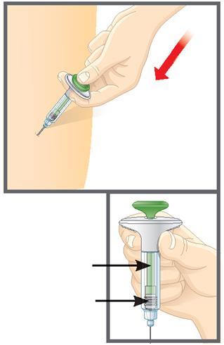 Mano che tiene un iniettore precompilato con ago inserito nella pelle e dettaglio del meccanismo di rilascio del farmaco con frecce nere