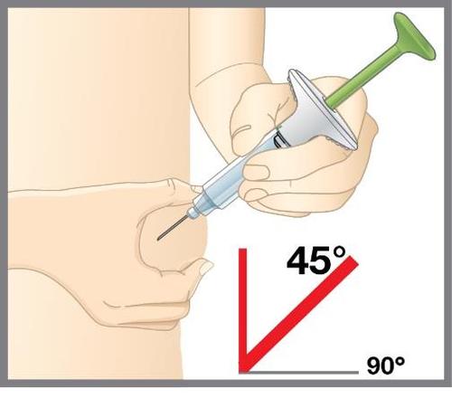 Mano che tiene una siringa verde e bianca con ago inserito nella pelle, angolo di 45 gradi indicato da una linea rossa su sfondo bianco