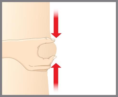 Mano che solleva un lembo di pelle con due frecce rosse verticali che indicano la direzione del movimento