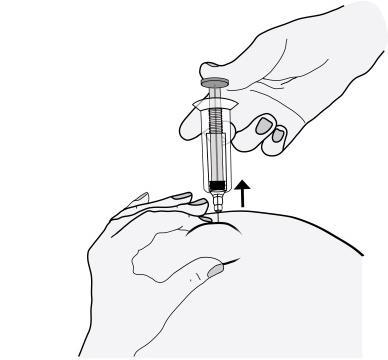 Mano che tiene una siringa e inietta il farmaco nel tessuto sottocutaneo del braccio con ago rivolto verso l