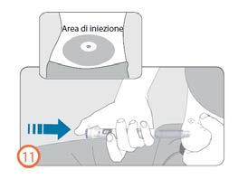 Mano che tiene una penna per iniezione con ago inserito nella pelle dell
