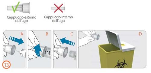 Siringa con cappuccio esterno e interno indicati, sequenza di preparazione all