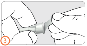 Mani che tengono e collegano due componenti cilindrici bianchi di un dispositivo medico con un angolo di inclinazione