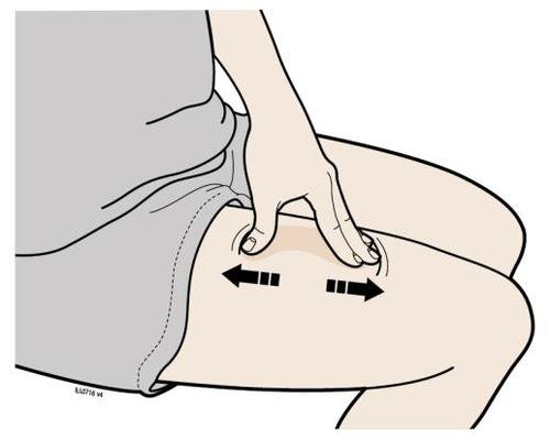 Mano che pizzica la pelle sulla coscia con frecce nere che indicano la direzione del movimento per creare una piega cutanea